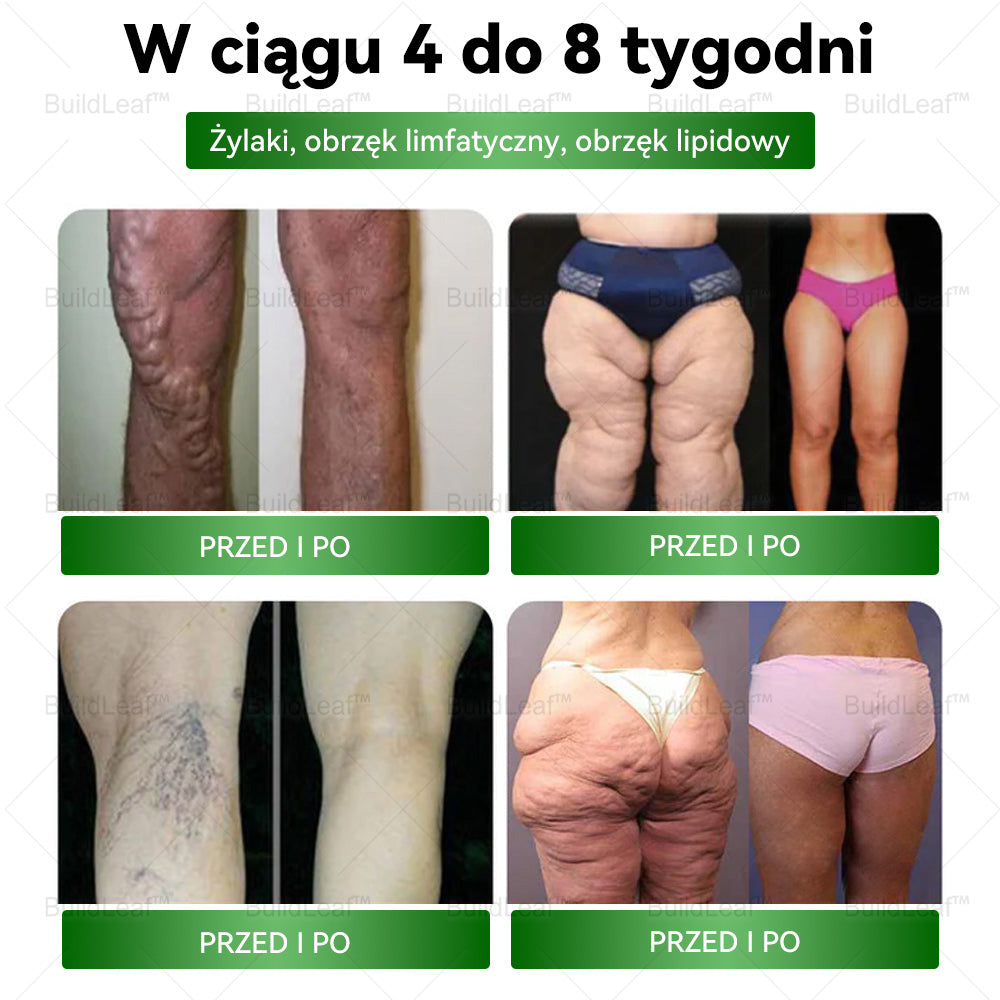 💥BuildLeaf® 🎁🎁 Ostatnia szansa! Zdobądź to szczęśliwe znalezisko 🎉50% TANIEJ!