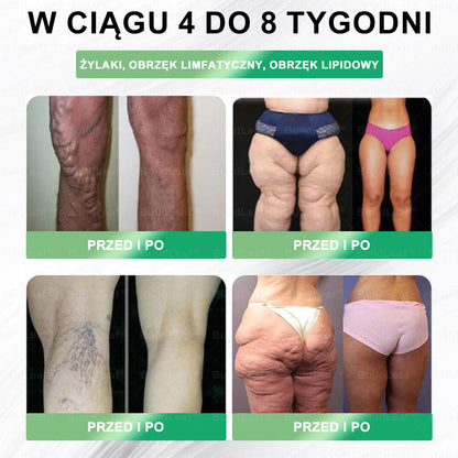 🔥 Oficjalny sklep Polska | 🌿 Zostało tylko 5 opakowań! BuildLeaf® oferuje 🎁 dodatkowe 40% zniżki! Przywróć równowagę swojego ciała i zdrowia. Skorzystaj teraz, później może nie być już takiej okazji.