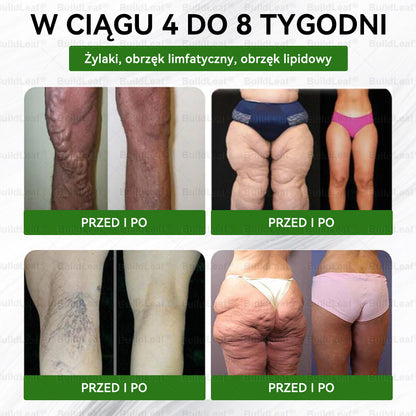 🎁Oficjalny sklep Polska |  🔥 Zostało tylko 5 opakowań! BuildLeaf® oferuje 🎁 dodatkowe 30% zniżki! Przywróć równowagę swojego ciała i zdrowia. Skorzystaj teraz, później może nie być już takiej okazji.